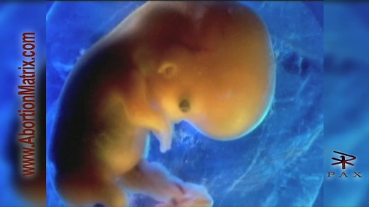 Abortion Matrix (1 of 10) Introduction