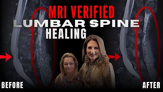 MRI VERIFIED!  Lumbar & Spine Healing! episode artwork